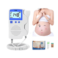 thumbnail image 2 of Detector De Frecuencia Cardíaca Fetal Doppler + Gel Batería, Belug, Blanco/Azul, 2 of 5