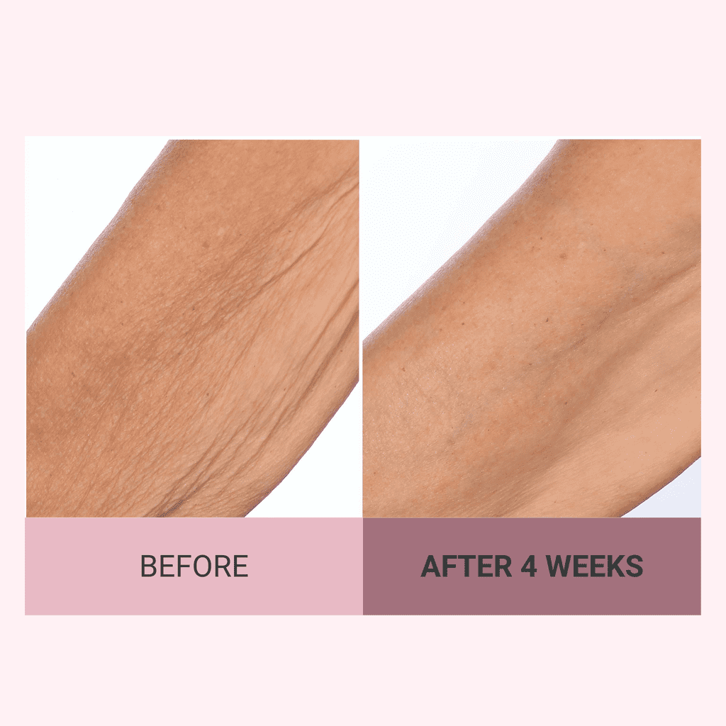 Consult Beaute Champagne Lift Hydrating Firming Body Cream with Pink Pepperslim, Tightens, Tones Crepey Skin, Moisturizer for Dry Skin, Warm Santal, 8 oz.