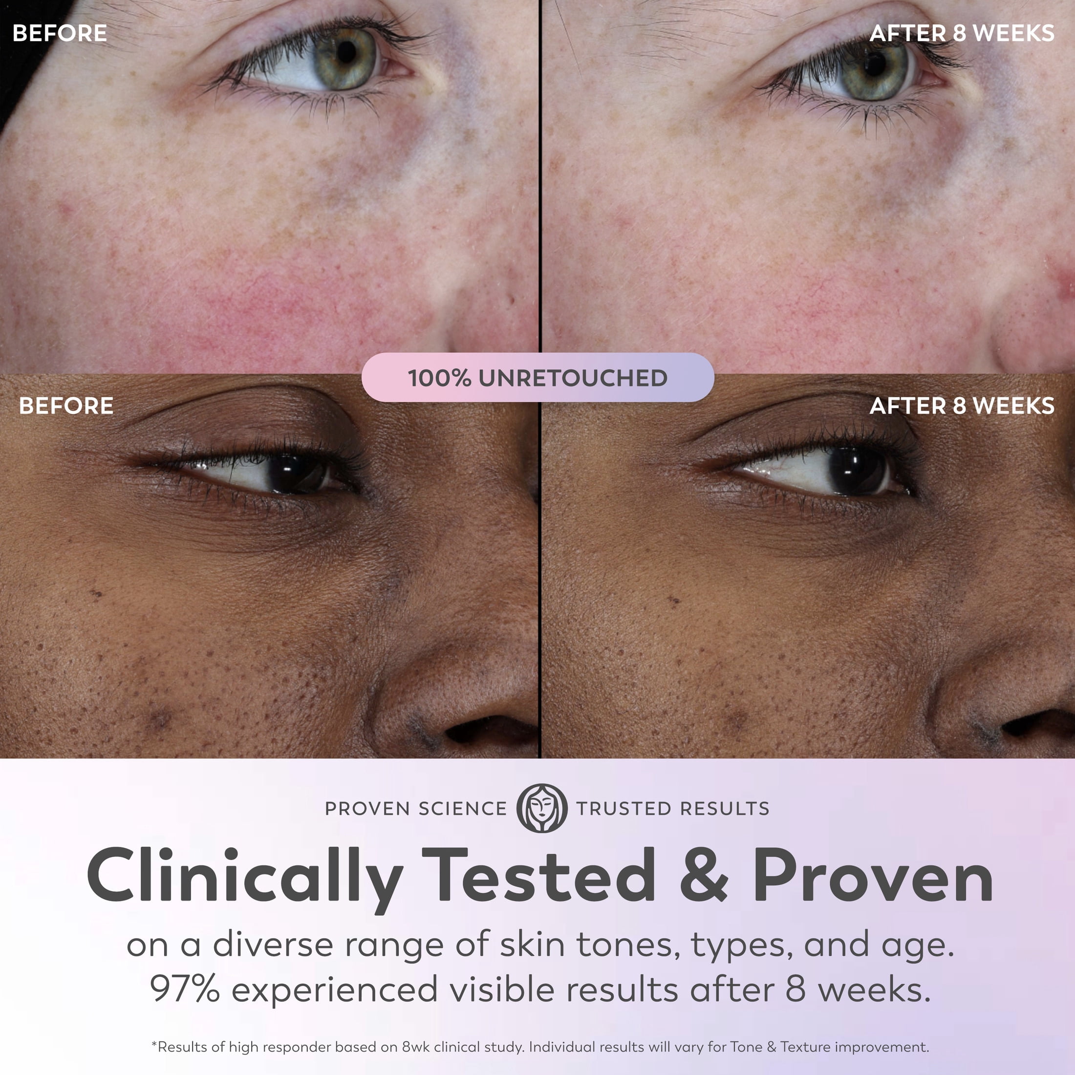 Olay Super Serum - Niacinamide, Vitamin C & E, Collagen Peptide, AHA - 5-in-1 Skin Care Benefits for Face - Healthy Glow, Brightening, Hydrating, Smoothing, Firming, Evens Tone, Anti-Aging, 1.7 Oz