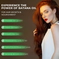 thumbnail image 3 of Aceite para el crecimiento del cabello Mysense Raw Batana 100% puro orgánico, 30 ml, 3 of 7