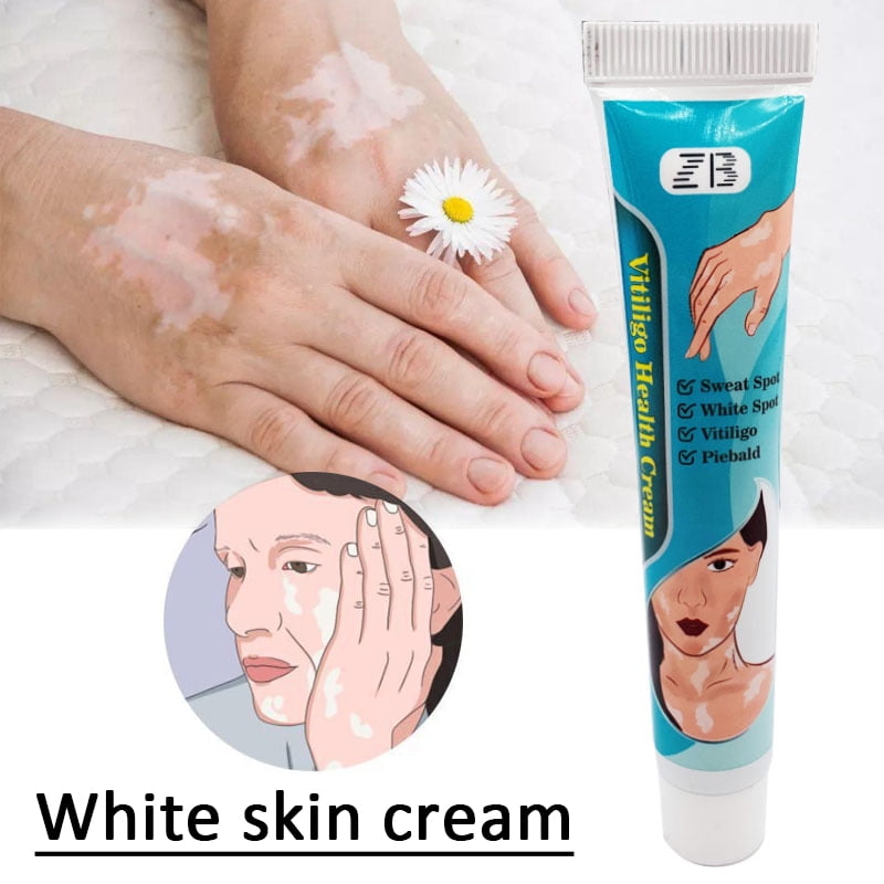 20g Vitiligo Treatment Cream Psoriasis Treatment Localized White Spot Reduces Antibacterial Cream Moisturizers Skin Care
