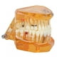 thumbnail image 5 of Modelo de implante ANGGREK 1 pieza color Naranja, 5 of 8