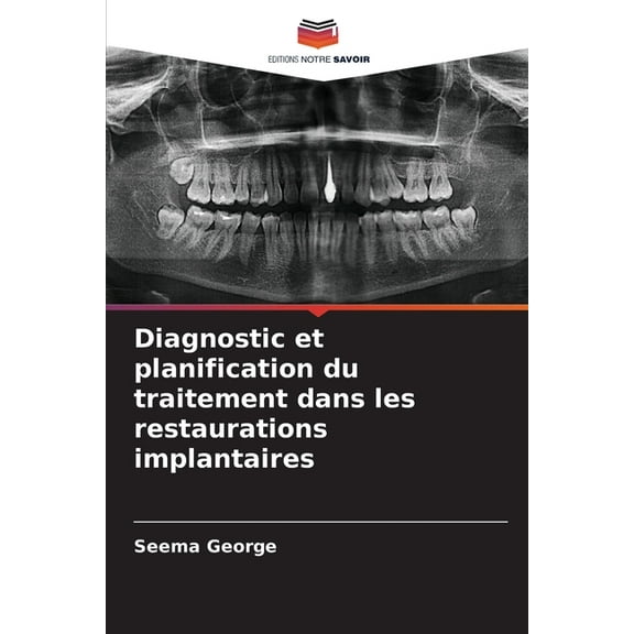Diagnostic et planification du traitement dans les restaurations implantaires, (Paperback)