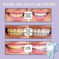 thumbnail image 3 of Jaysuing Mousse Toothpaste Pure White Bright White Tartar Tooth Stains Remove Bad Breath Fresh Breath Care Gum Toothpaste, 3 of 4