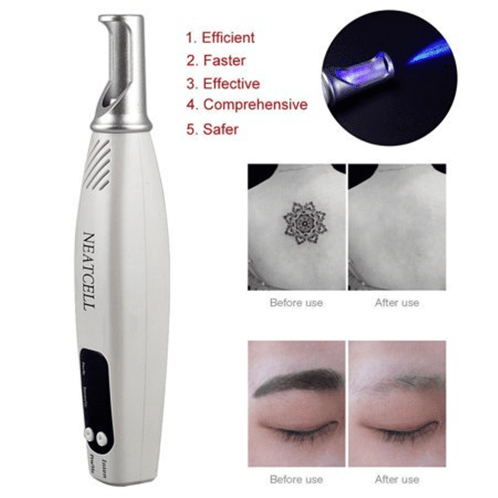 Tattoo Removal Pen Picosecond Impulse Light Machine for Mole Dark Spot  Professional Blue Light Scar Remove Device Rechargeable Enhanced Design :  Amazon.co.uk: Beauty