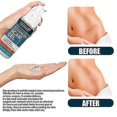 thumbnail image 5 of 3pcs Scar Gel Scar Repair Gel 30ml, 5 of 5