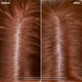 thumbnail image 3 of Biolage Scalp Sync Clarifying Shampoo | Removes Residue, Buildup & Excess Oil | Paraben & Silicone Free | For Oily Hair & Scalp | Vegan | Clarifying Salon Shampoo C29, 3 of 3