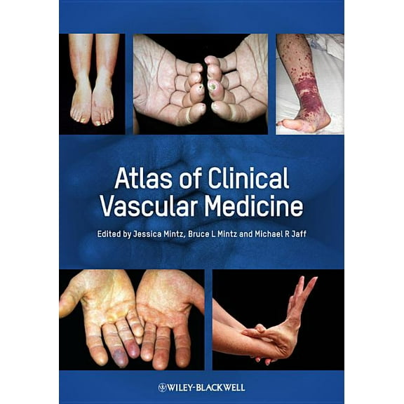 Atlas of Clinical Vascular Medicine, (Hardcover)