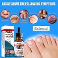 thumbnail image 2 of Fungal Nail Repair Treatment Hand & Foot Grey Nail Care Repair Grey Nail Solution Anti-Fungal Liquid for Thickened Yellow Nails, 2 of 5