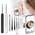 thumbnail image 2 of Ear Wax Removal Tool Kit with Camera Comfortable Painless Ear Picking Spoon Smart Visual Ear Cleaner with 6 Ear Scoops, 2 of 5