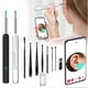 thumbnail image 2 of Ear Wax Removal Tool Kit with Camera Comfortable Painless Ear Picking Spoon Smart Visual Ear Cleaner with 6 Ear Scoops, 2 of 5