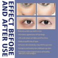 thumbnail image 4 of Crema activa para ojos: antiarrugas, elimina las ojeras y reduce las bolsas de los ojos, de Jaysuing -8164381430114, 4 of 4