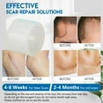 thumbnail image 3 of Silicone Scar Sheets,  Reusable Clear Face Scar Tape  For Post Surgery, 3 of 8