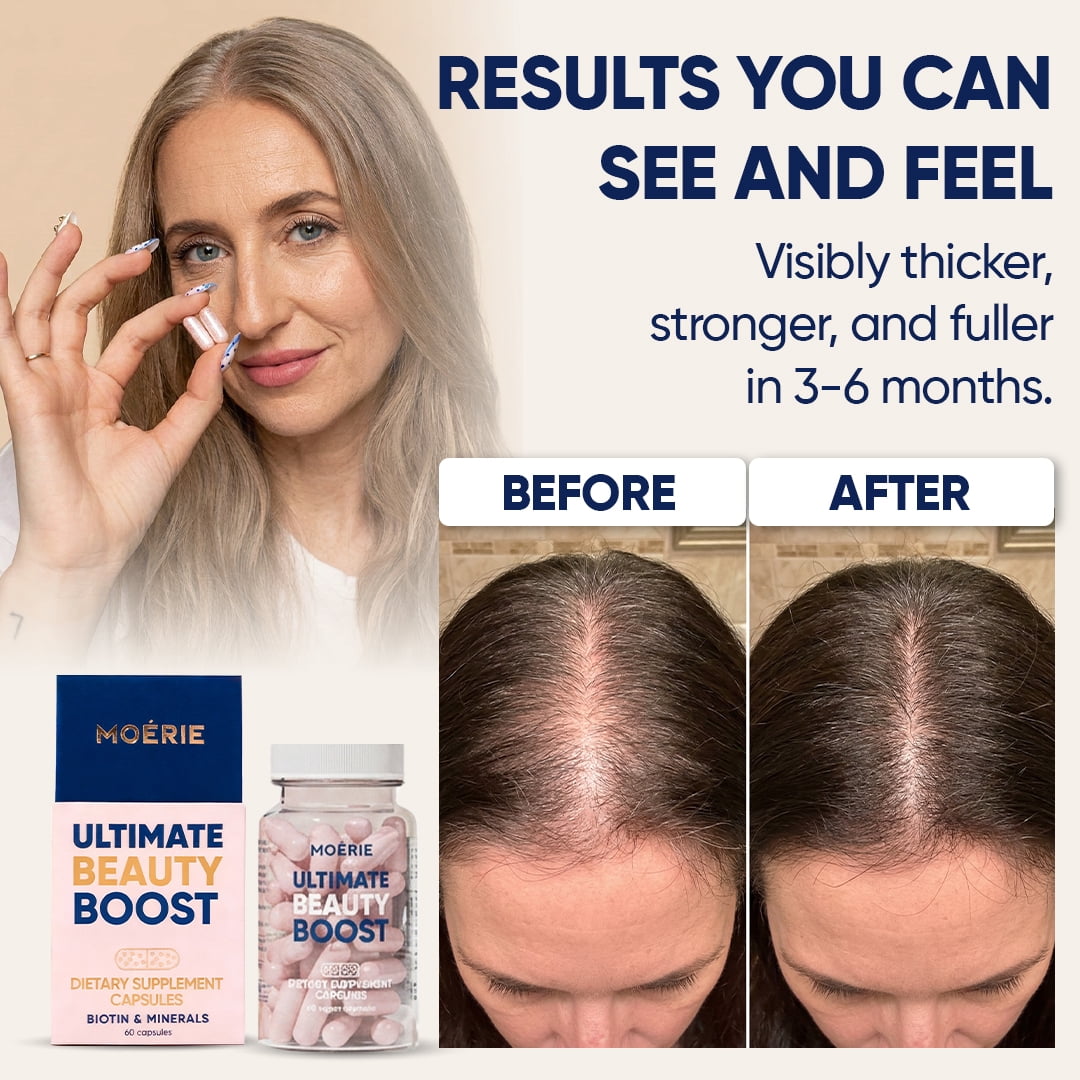 MOÉRIE Ultimate Beauty Boost Hair Growth Supplements, 6 pack - 360 capsules