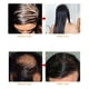 thumbnail image 1 of Peine Para El Crecimiento Del Cabello Para Reducir La Caída Del Cabello, Masajeador Anticaída Para Promover La Del Cabello, Herramienta De Cuidado De La Salud Para El, 1 of 7