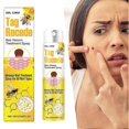 thumbnail image 5 of Ta-g Recede Bee-venom Repair Spray Portable Moles Wart Removal Liquid For Women Men, 5 of 5