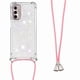 thumbnail image 3 of Funda FOXDOCK para Motorola Moto G Stylus 2022 5G con Cuerda Ajustable, Brillo Líquido, Protección Antigolpes y Lente – Ideal para Regalo, 3 of 6