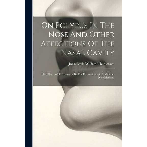 On Polypus In The Nose And Other Affections Of The Nasal Cavity: Their Successful Treatment By The Electro-caustic And Other New Methods (Paperback)