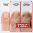 thumbnail image 4 of Cortaúñas para uñas de los pies KLIPP de acero inoxidable con mordaza ancha de 15 mm, 4 of 9