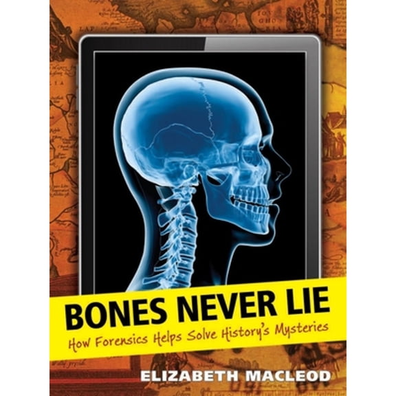 Pre-Owned Bones Never Lie: How Forensics Helps Solve History's Mysteries (Hardcover) 1554514835 9781554514830