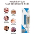 thumbnail image 5 of Liquid Anti Nail Toenail Fungus Care Solution Anti Fungal Nail Repair Liquid Anti Fungus Nail Liquid Nai, 5 of 5