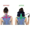 thumbnail image 3 of Cervical Neck Traction Device Inflatable Neck Stretcher, Easy to Use for Chronic Neck and Shoulder Pain Relief, 3 of 7