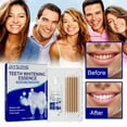 2 Pack Teeth Whitening Gel 44 Carbamide PeroxideQuick Whitening