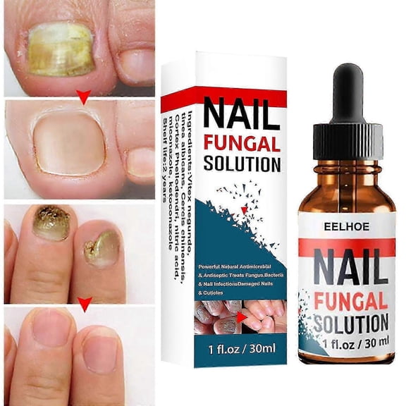 3PCS Nail Repair Solution Hand & Foot Grey Nail Care Repair Grey Nail Solution