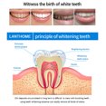 thumbnail image 4 of LILELIS 2pc Effective Tooth Cleaning Tools Spiral Instant Whiten Gel Teeth Pen 4ML after Brushing ning Booster Water Wash Teeth, 4 of 8