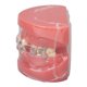 thumbnail image 1 of Modelo Dental de Ortodoncia NikouMX Resina, 1 of 8