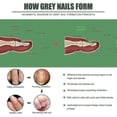 thumbnail image 2 of Lápiz reparador de uñas, 3 unidades, tratamiento para hongos en las uñas, cuidado de los pies, antiinfecciones por hongos en las uñas, eliminación de paroniquia en los pies, onicomicosis de los dedo, 2 of 5