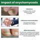 thumbnail image 4 of 30ml Nail Treatment Essence For Onychomycosis Mild Non-irritating Nail Bright Shiny Repair Nail Repair Solution, 4 of 5