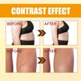 thumbnail image 3 of Tourmaline Ionic Stretch Socks, Prevent Slip Slimming Elastic Socks Soft Increase Metabolism 3 Pair Breathable  For Sports, 3 of 8
