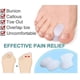 thumbnail image 3 of Corrector de gel BRILLAR para dedos de los pies 8 separadores para aliviar el dolor de Hallux Valgus, 3 of 5