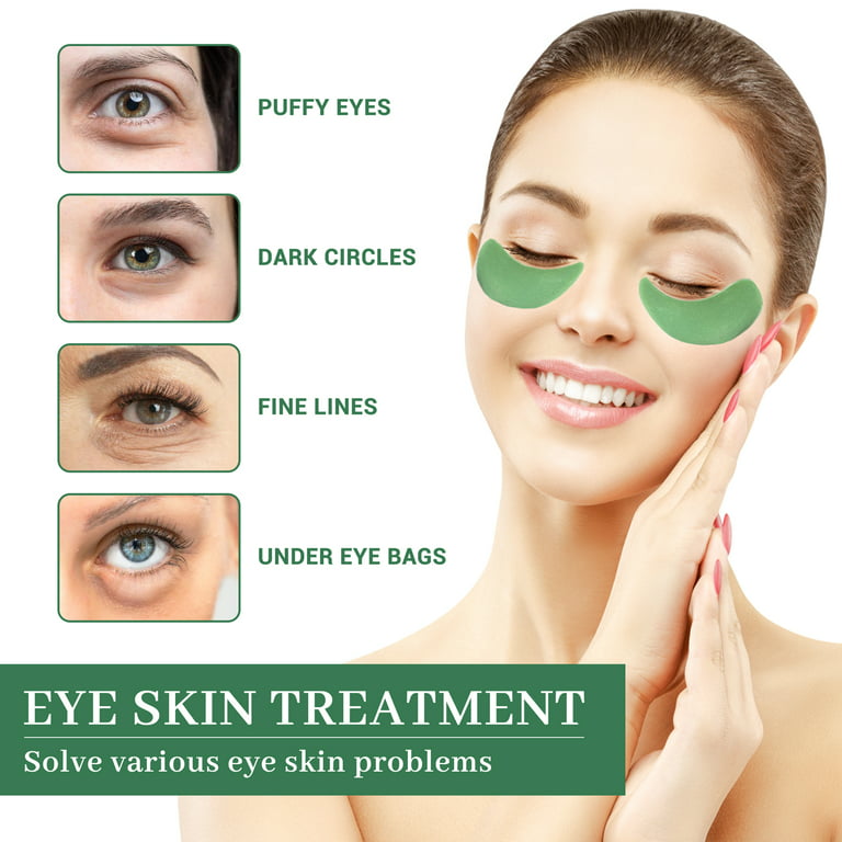 Puffy Eyes and Dark Circles Treatment