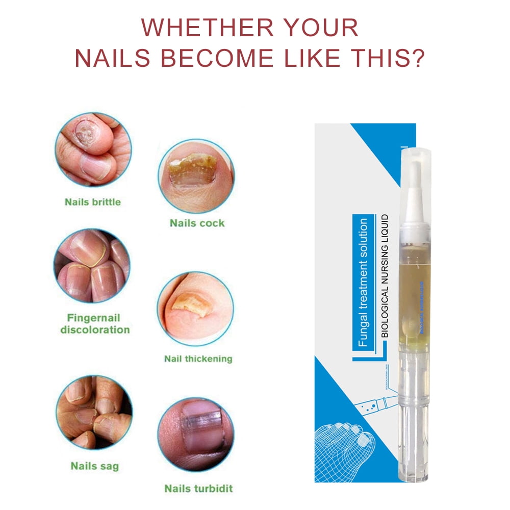 Alvantor Advanced Antifungal Nail Treatment Pen for Damaged Yellow Nails, 0.1 fl oz