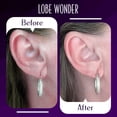 thumbnail image 3 of Lobe Miracle Earring Support Patches Instantly Makes Torn, Stretched Lobes No Longer Visible, Box of 60, 3 of 8