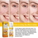 thumbnail image 2 of Crema para tratar el acné Crema para tratar el acné quístico, hormonal y severo Crema para tratar el acné en adolescentes y adultos, 2 of 5