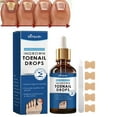 thumbnail image 2 of Natural Ingrown Toenail Treatment Drops - 30ml Cuticle Care Oil for Nail Correction, 2 of 8