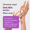 thumbnail image 4 of Crema Hidratante de Queratosis Pilaris de 3 oz con 15% de Ácido Láctico: Exfoliante E Hidratante para Pieles Secas, Ásperas y con Baches, 4 of 6