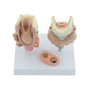 Milue Anatomical Laryngeal Model Medical Teaching Aids