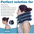 thumbnail image 2 of Cervical Traction Device (Blue) for Neck Support, Neck Traction and Neck Pain Relief, 2 of 5
