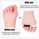 thumbnail image 5 of 10 Pack Finger Buddy Straps,Buddy Tape Finger Wraps,No-Slip Buddy Loops Finger, 5 of 5