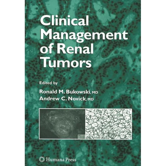 Clinical Management of Renal Tumors, (Hardcover)