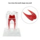 thumbnail image 5 of Modelo de Dientes Dentos de PlásTico Separables Endodoncia HerramientA Educata de Estudiantes, 5 of 7