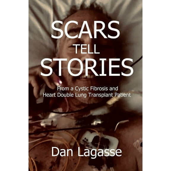 Scars Tell Stories: From a Cystic Fibrosis and Heart/Double Lung Transplant Patient (Paperback)