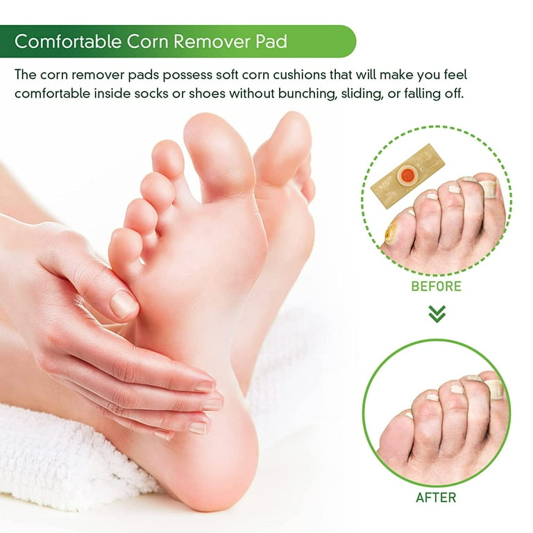 Corn Removers for Feet, 24 Pack, 2 Size Corn Removers for Toe
