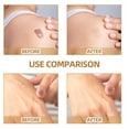thumbnail image 4 of 60x up Sticker Color carne Invisible Skin Blemish Cover Cicatrices para rasguños Tatuajes Contusiones shamjiam Parche de cobertura, 4 of 9