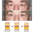 thumbnail image 3 of Men's Retinol Eye Cream - Anti-Wrinkle, Brightening, Moisturizing & Firming for Dark Circles & Puffiness, 3 of 5