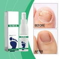 thumbnail image 5 of Herunwer Tea Tree Oil Foot Spray, Foot Sanitizer Spray, Foot and Nail Care Serum Kit, with Natural Tea Tree Oil and Aloe Vera Foot Spray (1Pcs), 5 of 10